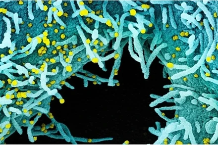 Ảnh: NIAID / Flickr.