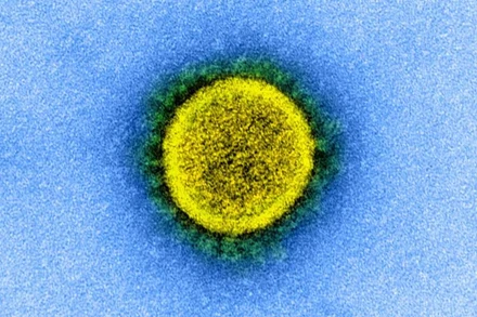 Virus SARS-CoV-2 qua kính hiển vi điện tử. Nguồn: NIH.
