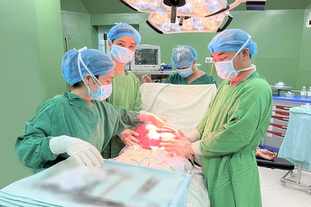 Khối u nặng 4,5 kg được tách bóc thành công ra khỏi ổ bụng bệnh nhân.