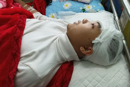 Học sinh Phan Thanh Lâm bị thương vùng đầu đang được chăm sóc, điều trị tại Bệnh viện Đa khoa tỉnh Thanh Hóa.