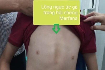 (Ảnh: BS cung cấp)