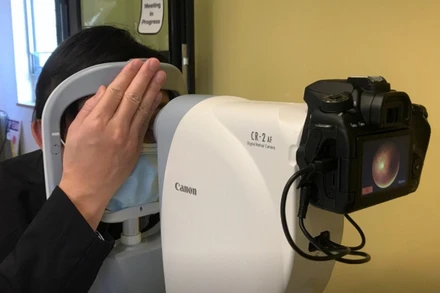 Giáo sư Benny Zee, Đại học Hồng Kông, Trung Quốc thử nghiệm máy quét võng mạc nhằm phát hiện chứng bệnh tự kỷ ở trẻ em. Ảnh: Reuters.