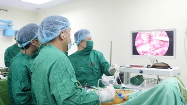 Các bác sĩ tiến hành phẫu thuật lấy thận hiến từ người sống.
