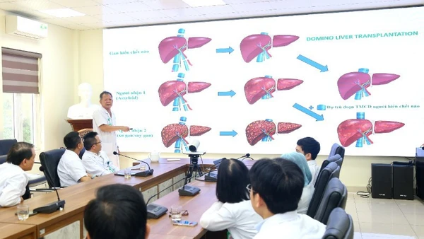 Phó Giáo sư, Tiến sĩ Dương Đức Hùng, Giám đốc Bệnh viện Hữu nghị Việt Đức cùng các bác sĩ hội chẩn trường hợp ghép tạng domino đặc biệt.