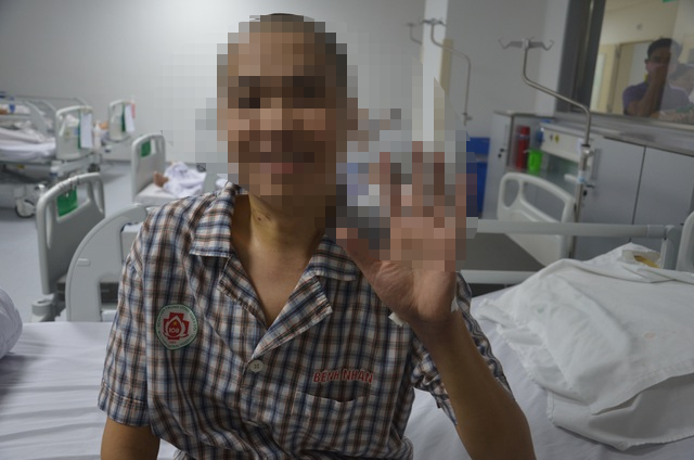 Bệnh nhân phục hồi tốt sau phẫu thuật. Tìm lại được dáng đứng thẳng sau 22 năm gù gập như con tôm -0