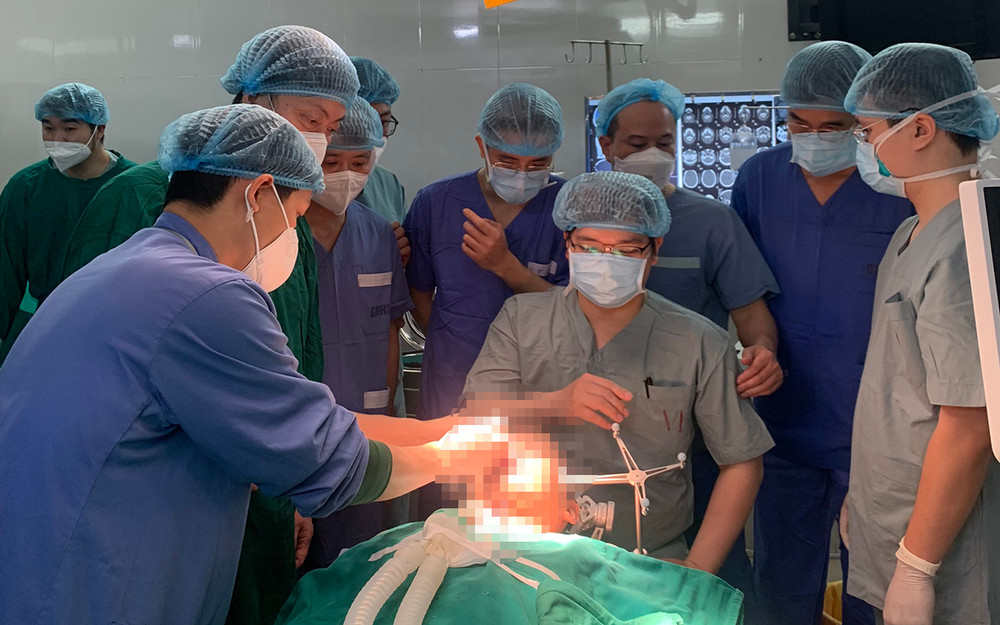 Cuộc phẫu thuật kéo dài 10 giờ đồng hồ với 2 can thiệp sọ trán và hàm mặt. Một cuộc phẫu thuật, giải quyết 2 bệnh lý phức tạp -0