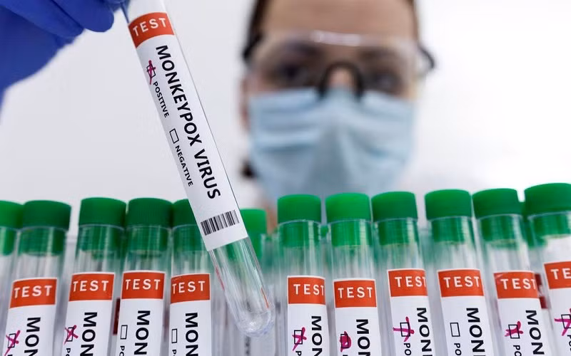Các ống nghiệm dán nhãn "dương tính với virus đậu mùa khỉ". (Ảnh minh họa: REUTERS)