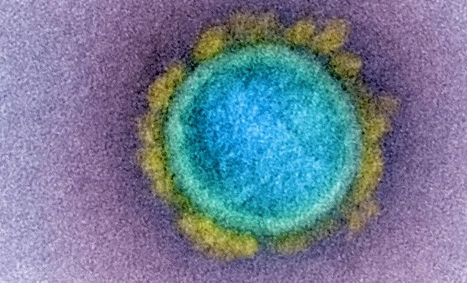 Hình ảnh virus SARS-CoV-2. Ảnh: Flickr. Biến thể virus ở Anh phát triển đột biến để trốn tránh vaccine -0