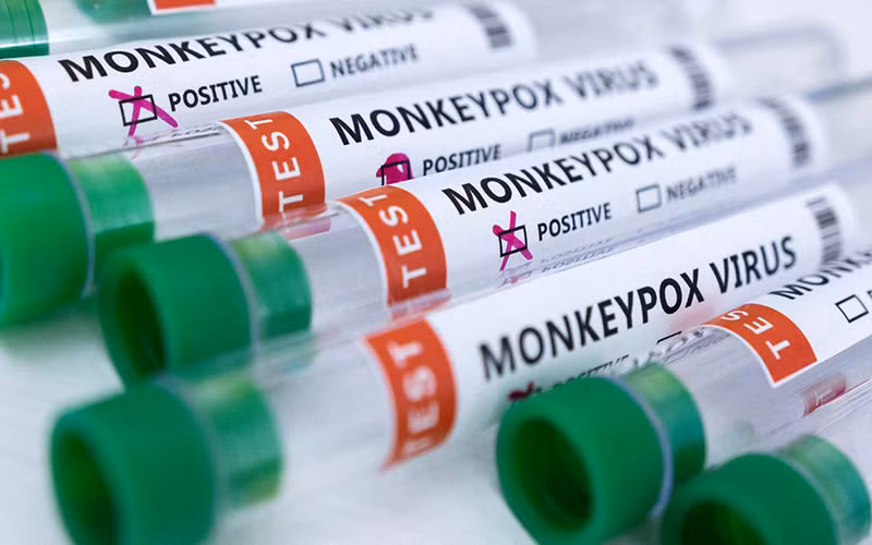 Ống đựng mẫu bệnh phẩm dương tính với virus gây bệnh đậu mùa khỉ. (Ảnh: Reuters)