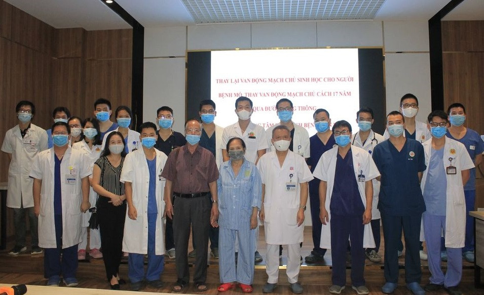 Các bác sĩ chúc mừng bệnh nhân sau ca phẫu thuật. Bệnh nhân đầu tiên tại Việt Nam được thay lại van tim nhân tạo bị thoái hóa -0