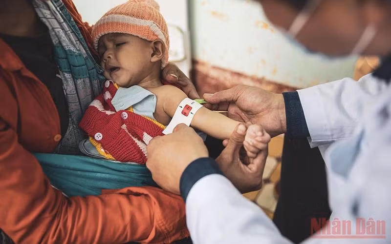 UNICEF kêu gọi cần đẩy mạnh nỗ lực đưa việc điều trị trẻ em suy dinh dưỡng cấp tính vào luật Việt Nam. (Ảnh: UNICEF)