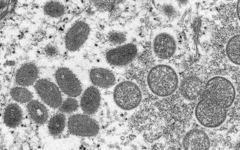 Hình ảnh virus đậu mùa khỉ trưởng thành (hình bầu dục) và chưa trưởng thành (hình cầu) dưới kính hiển vi. (Ảnh: CDC/REUTERS)