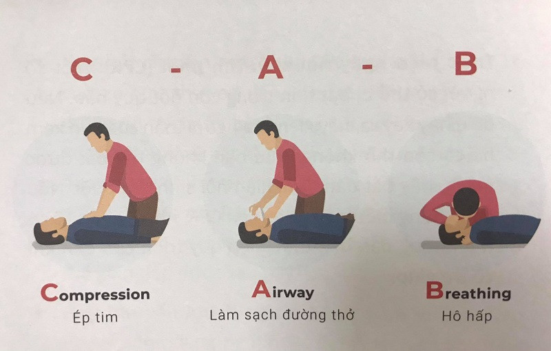 Kỹ thuật hồi sinh tim phổi. Sai lầm khi bỏ qua thời gian vàng chữa đột quỵ não -0