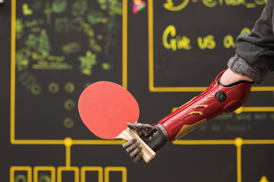 Chân tay giả đã có một bước tiến dài kể từ những năm 1980. Công ty của Anh Open Bionics đã tạo ra "Cánh tay anh hùng" sinh học, nhẹ, giá rẻ cho trẻ em và người lớn. Thông qua quét 3D, tay chân giả được tùy chỉnh cho từng người. Ảnh: Open Biotics. Những phát minh được hiện thực hóa từ khoa học viễn tưởng -0