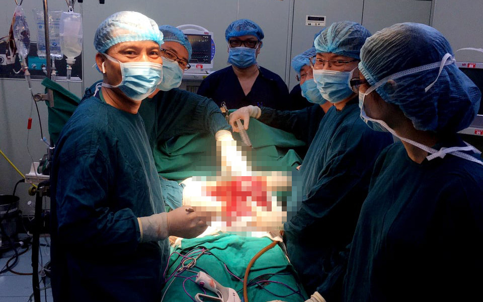 Hai kíp mổ sản khoa và ngoại khoa đã phối hợp nhuần nhuyễn để lấy thai nhi và cắt khổi u một cách an toàn. Loại bỏ u gan hiếm gặp nặng 3 kg cho sản phụ 37 tuần thai -0