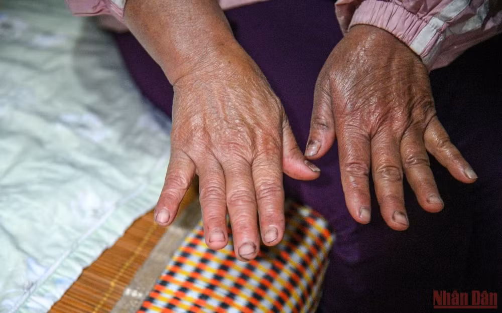 Dân ngụ cư ven sông Hồng chống rét -0