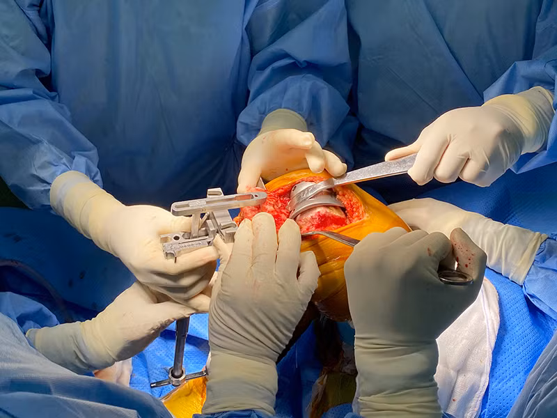 Ê kíp bác sĩ Bệnh viện Chợ Rẫy phẫu thuật cho bệnh nhân.