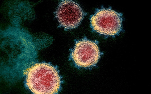 Virus SARS-CoV-2 qua kính hiển vi điện tử. Ảnh: NIAID.