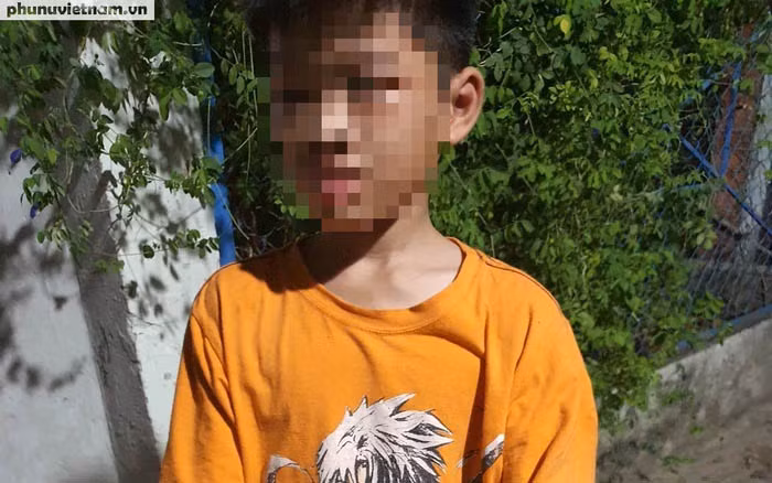 Bé H.A bị cha ruột đánh (Ảnh: Báo Phụ nữ Việt Nam)