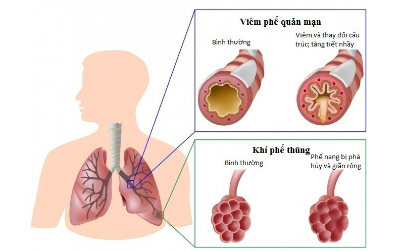 (Ảnh minh họa)