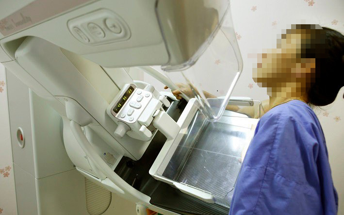 Bệnh nhân được chụp X-quang tầm soát ung thư. Trì hoãn đi khám vì đại dịch, nhiều người phát hiện ung thư ở giai đoạn muộn -0