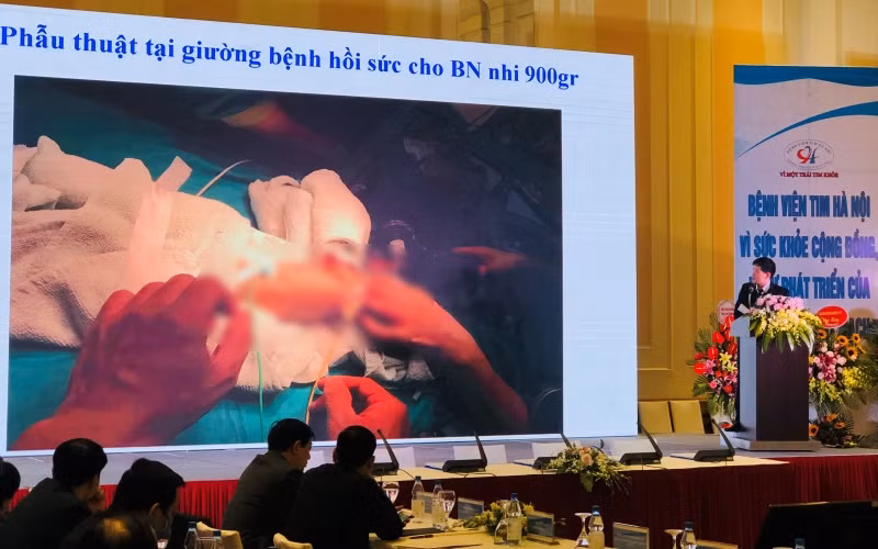 PGS, TS Nguyễn Sinh Hiền, Giám đốc Bệnh viện Tim Hà Nội trao đổi về các kỹ thuật phẫu thuật tim mạch.