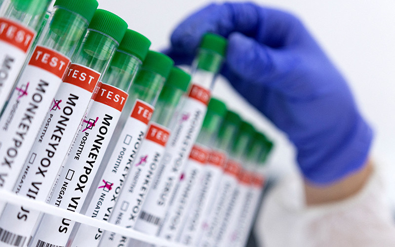 Ống đựng mẫu bệnh phẩm có đánh dấu dương tính với virus gây đậu mùa khỉ. (Ảnh: Reuters)