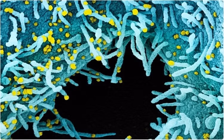 Ảnh: NIAID / Flickr.