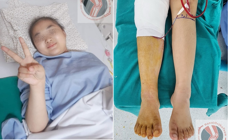 Bệnh nhi đang dần bình phục sức khỏe với đôi bàn chân mới. 