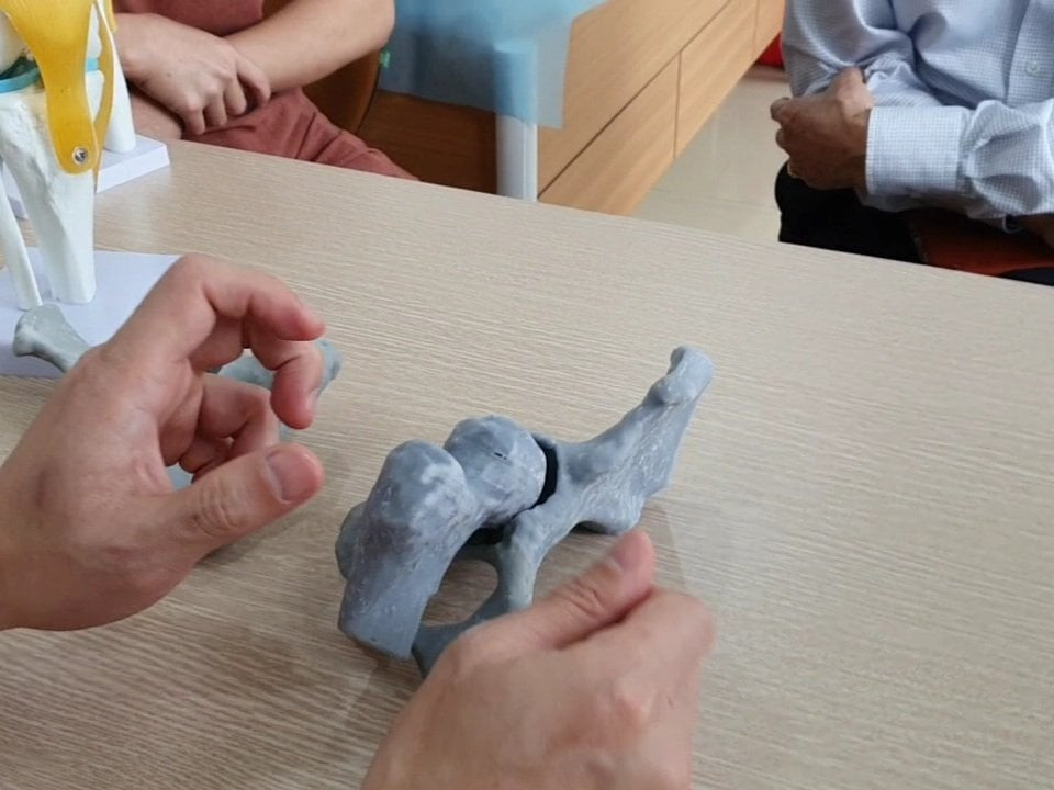 "Thực nghiệm y khoa 3D" trên mô hình tỷ lệ 1:1 khớp háng của bệnh nhân. Lần đầu tiên, Việt Nam thực nghiệm phẫu thuật bằng công nghệ 3D -0