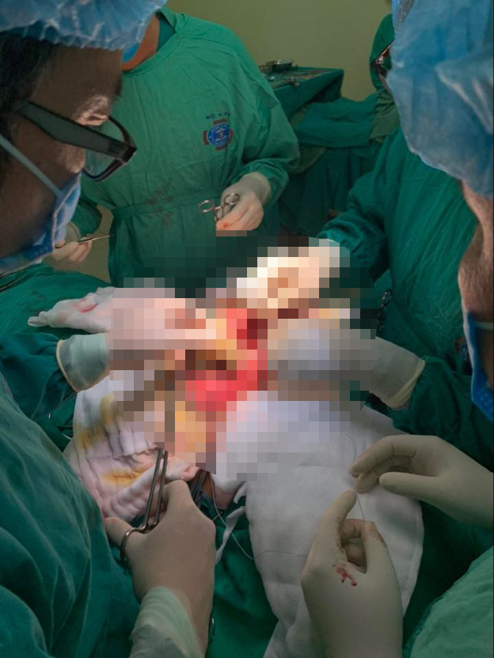 Bệnh nhân nhỏ tuổi nhất Việt Nam được thay toàn bộ xương bả vai bằng vật liệu sinh học. Lần đầu tiên thay xương bả vai cho bệnh nhi nhỏ tuổi nhất Việt Nam -0