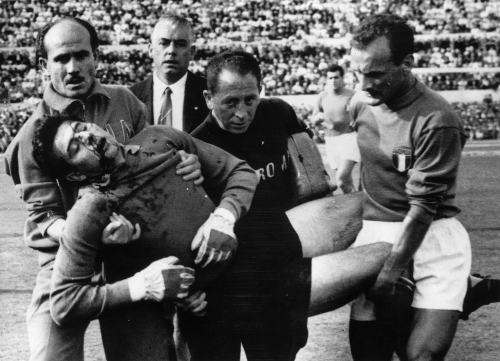 Thủ môn Lorenzo Buffon của Italia được đưa ra khỏi sân với khuôn mặt đầm đìa máu sau khi dũng cảm cứu thua ở phút 55. Lorenzo là người họ hàng với ông nội của thủ môn Gianluigi Buffon hiện tại. Trong trận giao hữu diễn ra trên sân Stadio Olimpico ở Roma tháng 5/1961, tuyển Anh bị đội chủ nhà dẫn trước 2-1 khi trận đấu còn 13 phút. Nhưng hai bàn thắng của Gerry Hitchens và Jimmy Greaves giúp đội bóng của huấn luyện viên Walter Winterbottom ngược dòng thắng chung cuộc 3-2. (Ảnh: Getty Images) Những khoảnh khắc đáng nhớ trong lịch sử đối đầu Italia - Anh -0