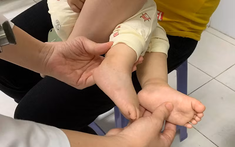 Số ca mắc tăng nhanh, cảnh giác trước mùa dịch tay chân miệng -0