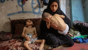 Trẻ em Gaza bị suy dinh dưỡng. (Ảnh: THX/TTXVN)