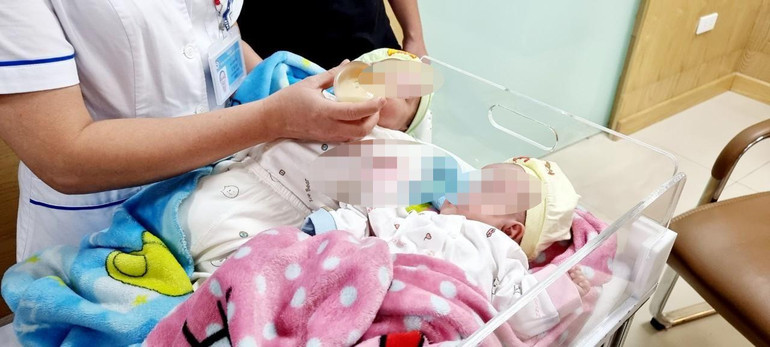 Hai bé song sinh được chăm sóc đặc biệt.