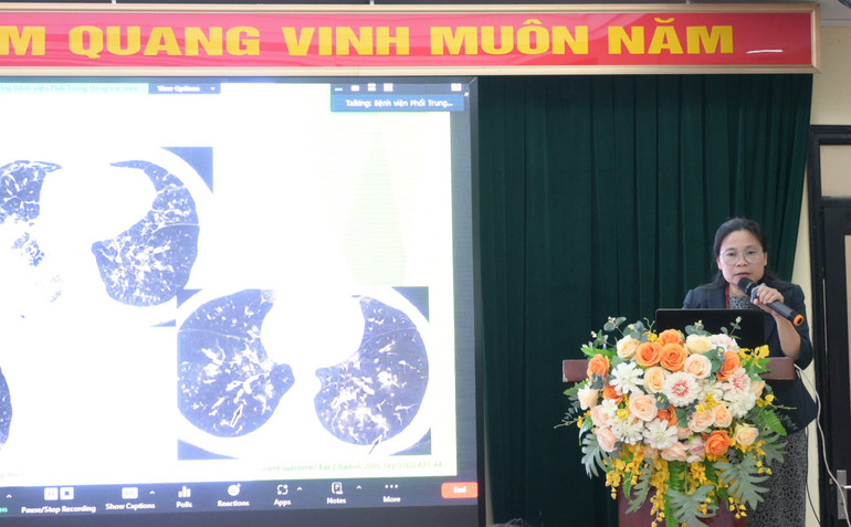 Tiến sĩ, bác sĩ Nguyễn Thị Bích Ngọc chia sẻ về phương pháp phát hiện, điều trị bệnh nấm phổi. Tiến sĩ, bác sĩ Nguyễn Thị Bích Ngọc chia sẻ về phương pháp phát hiện, điều trị bệnh nấm phổi.