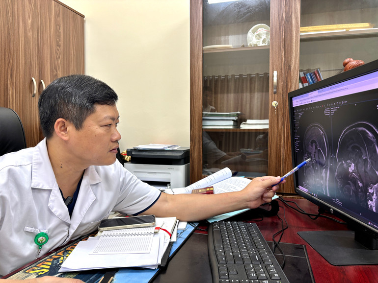 Tiến sĩ, bác sĩ Nguyễn Duy Tuyển, Trưởng khoa Phẫu thuật Thần kinh 2, Bệnh viện Hữu nghị Việt Đức hội chẩn cùng các đồng nghiệp, lựa chọn phương án phẫu thuật tốt nhất cho người bệnh.