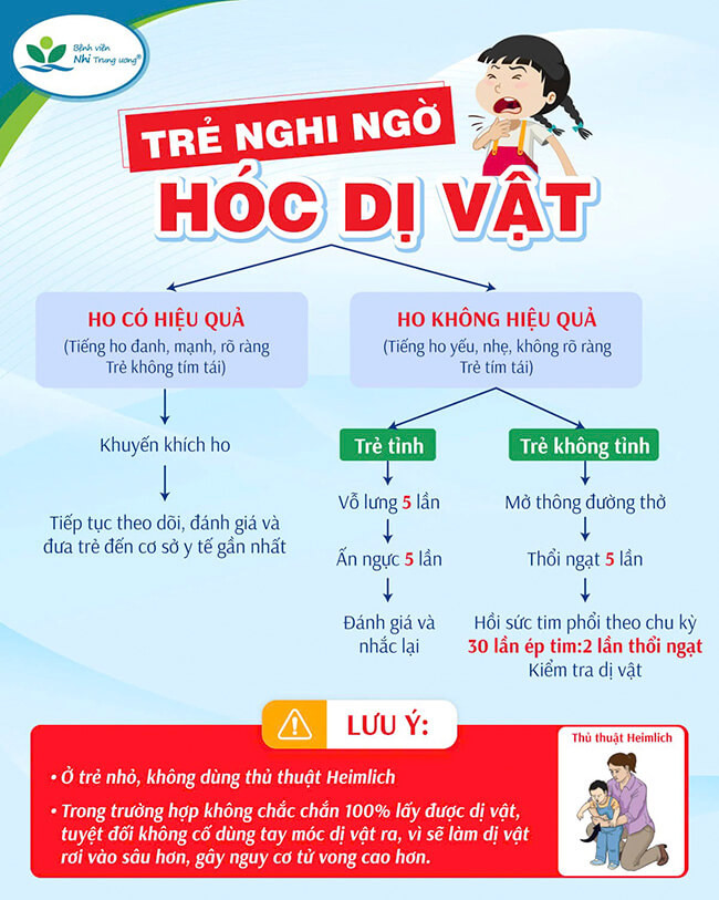 Infographic cách sơ cứu trẻ bị hóc dị vật. (BV cung cấp)