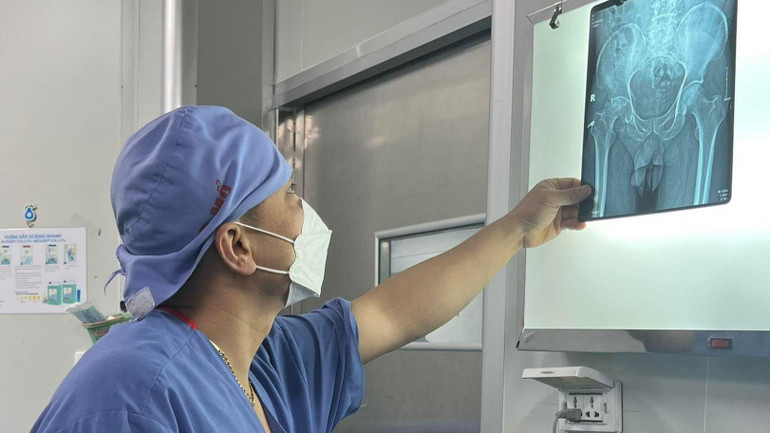 Nhiều người trẻ đang trong độ tuổi lao động bị hoại tử chỏm xương đùi.