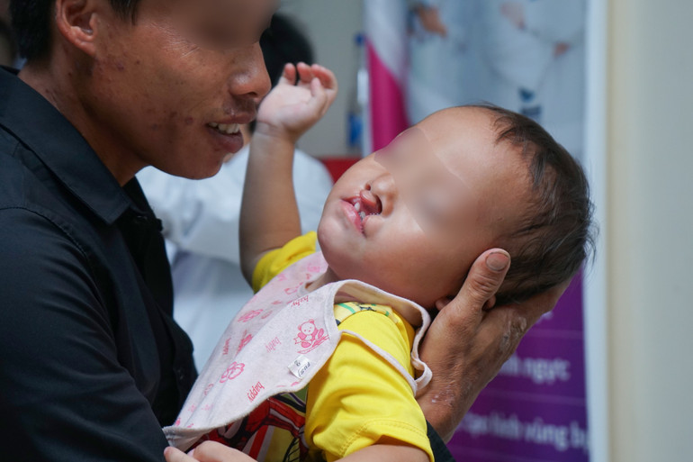 Bệnh nhi dị tật bẩm sinh được thăm khám, sắp xếp lịch phẫu thuật.