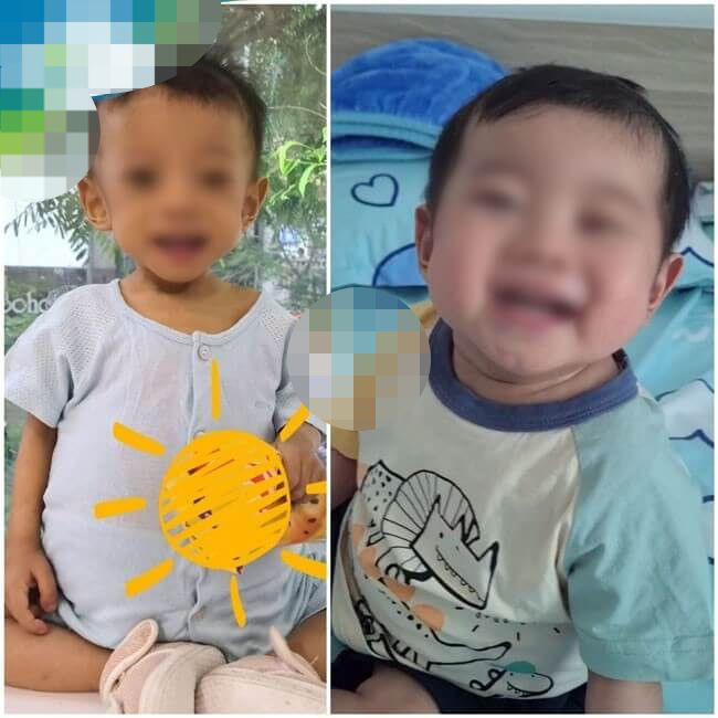 Nhiều bệnh nhi được hồi sinh sau khi được ghép gan.