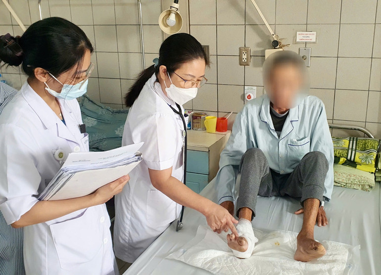 Bệnh nhân phải cắt cụt chân trái và đang loét bàn chân phải do biến chứng của đái tháo đường.