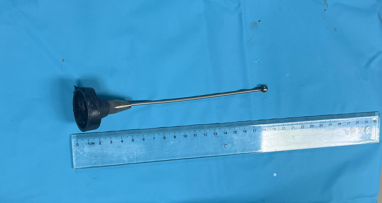 Dị vật gây ra tổn thương cho bệnh nhân.