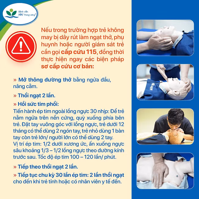 Hướng dẫn sơ cứu cơ bản của Bệnh viện Nhi Trung ương.