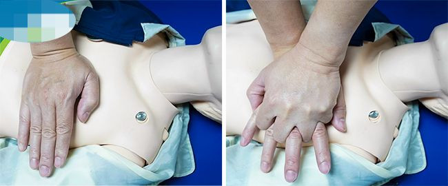 Ép tim ngoài lồng ngực.