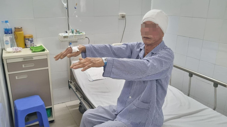 Bệnh nhân tỉnh táo, vận động tốt sau mổ 1 ngày.