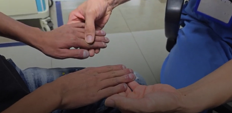 Đầu ngón tay của bệnh nhân to bất thường