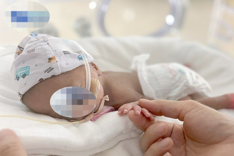 Trẻ sinh non được các y, bác sĩ tận tâm chăm sóc. Trẻ sinh non được các y, bác sĩ tận tâm chăm sóc.