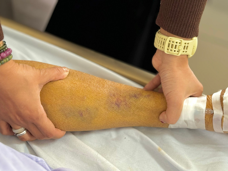 Triệu chứng vàng da của bệnh nhân.