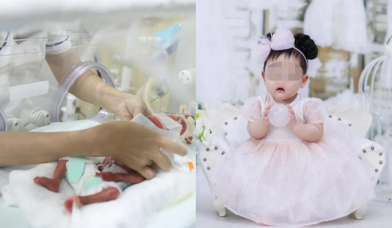 Nhiều trẻ sinh non đã phát triển khỏe mạnh. Nhiều trẻ sinh non đã phát triển khỏe mạnh.